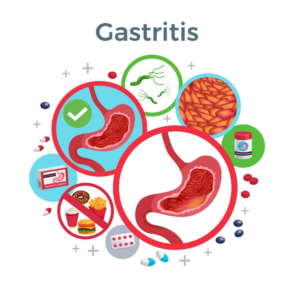 best gastroenterologist in Borivali